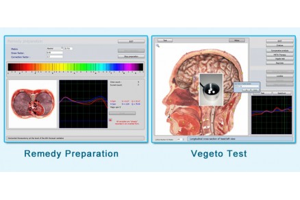 Computer non linear diagnostics
