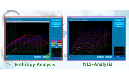 Metatron Hunter with Progress Of the NLS Method.