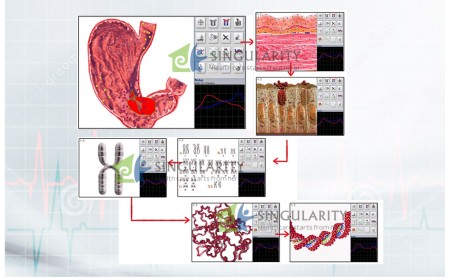 The Benefits Of Meta Hunter Method For Vascular Pathology Diagnosis