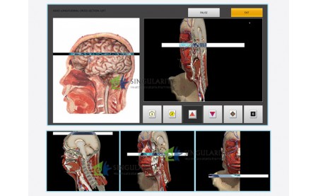 NLS Diagnostics Method Is Still Being Developed